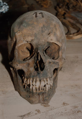 Fotografía de cráneo encontrado durante peritajes forenses
